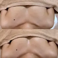 女性ホルモン整え！バストアップ×オイル×亜鉛