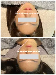 【お試しクイック】お顔、頭、をゆるめる