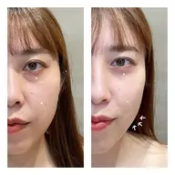 当日限定価格🎀💡リフトアップ！光フェイシャル¥6600→¥3900