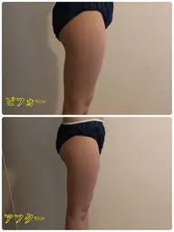 上半身or下半身 筋膜リリース