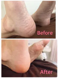 【40代からの足元リセット】かかとガサガサ卒業✨足裏角質ケア