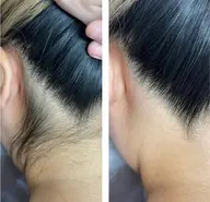 後ろ姿美人【女性】前撮り・式典にも🤎🕊うなじワックス✨光脱毛追加+¥2,000 メッセージでお知らせください