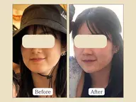 最先端よもぎ蒸し＋小顔美肌ケア80分¥9,800→¥6,800