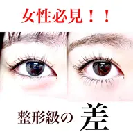 ラッシュリフト【上下】