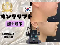 オンダリフト30分|頬~顎下80kj~140kj
