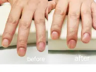 メンズハンドケア