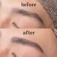 ハリウッドブロウリフト