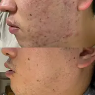 プロセルセラピーズ‐フェイシャル‐※モニター様