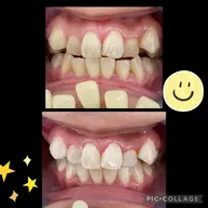 【新価格】初回スタンダードコース 9分光を3セット