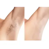 脇（男性・女性可能）