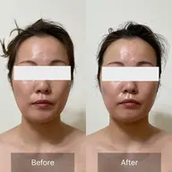 お顔のたるみ上がりすぎ注意⚠️WINBACKフェイシャル&首肩コリケア