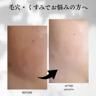 【人気No.1】毛穴・くすみ・肌荒れ改善フェイシャル✨