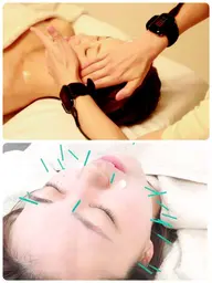 👑人気No.1👑ラジオ波➕美容鍼