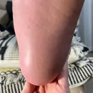 足裏かかと、角質ごっそりスッキリケア♡