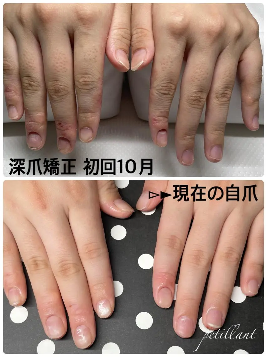 ネイル 長さ出し ジェルネイル nail salon petillantのネイルデザイン