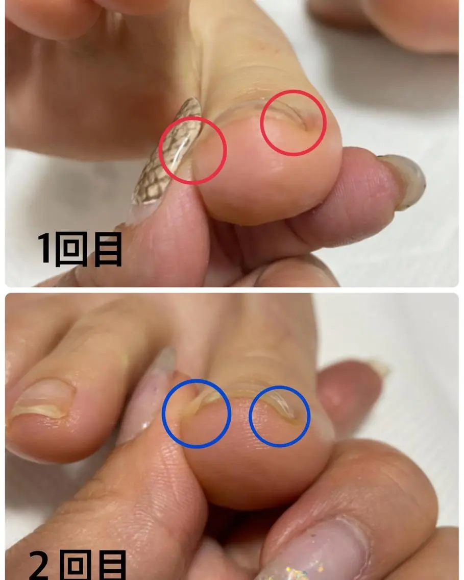 ネイル アートネイル フレンチネイル ジェルネイル グラデーション マグネットネイル フットネイル Nail 331のネイルデザイン