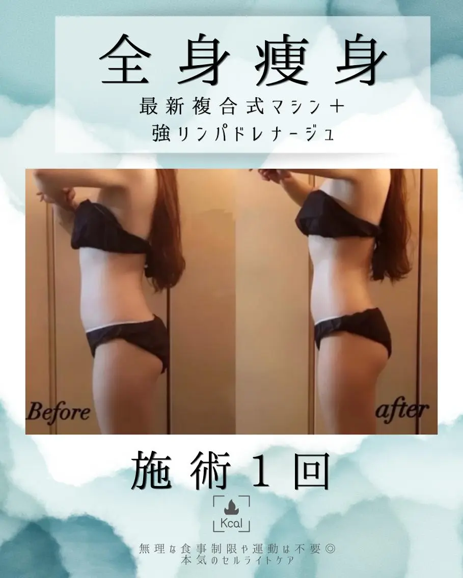 エステ 医療提携 肌管理痩身エステ池袋のエステ・リラクイメージ