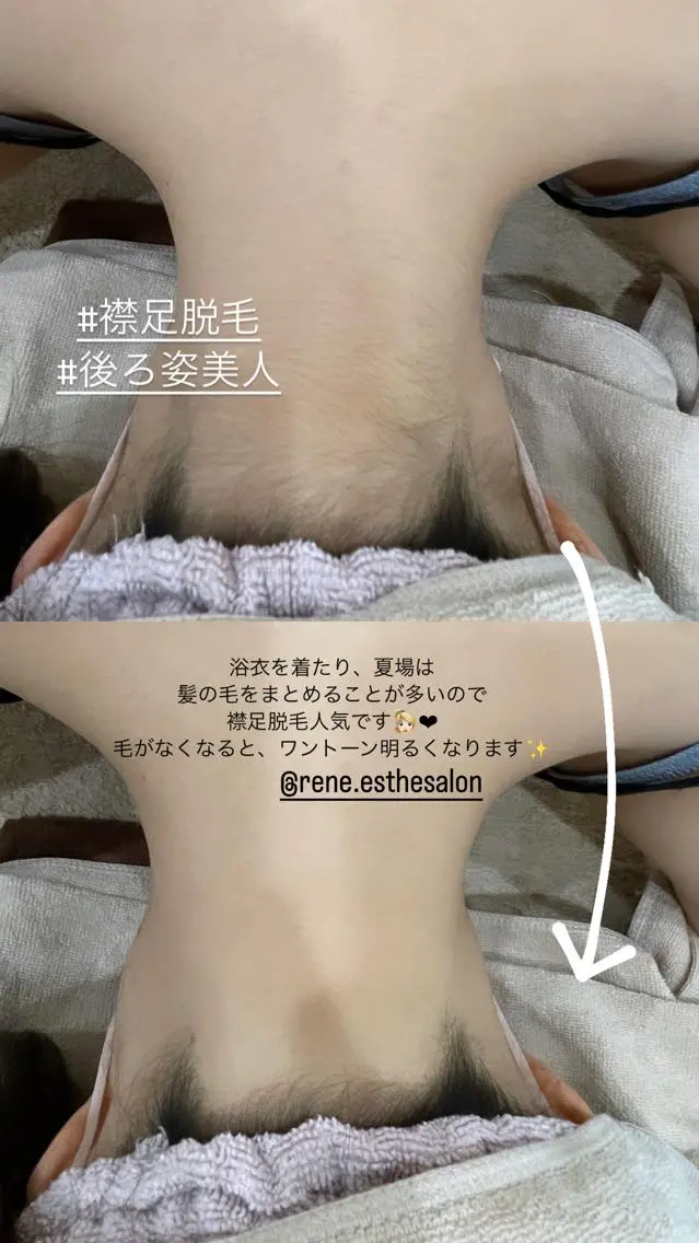 Rene 慢性疲労ケアサロンのエステ・リラクイメージ