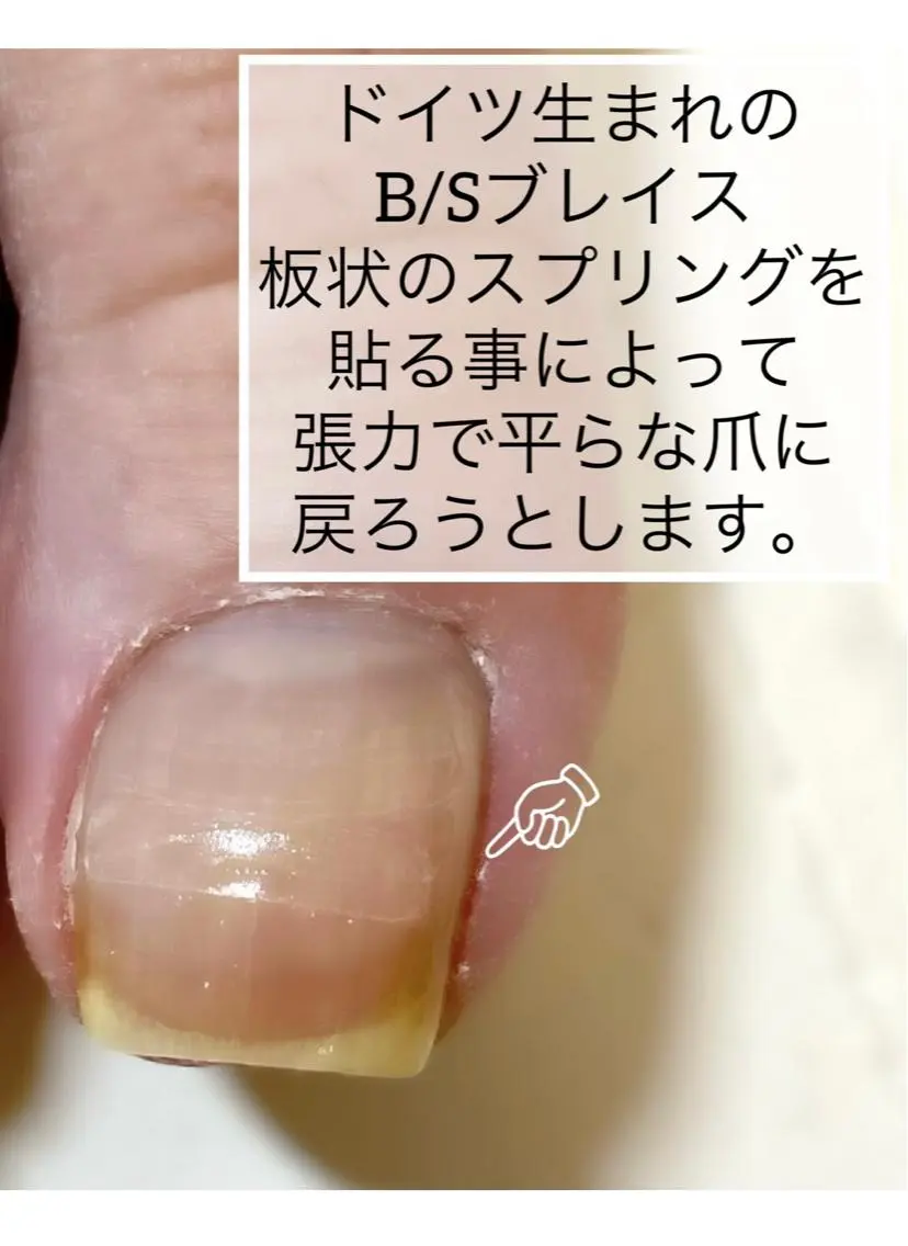 ネイル フットネイル JILL sa-yaのネイルデザイン