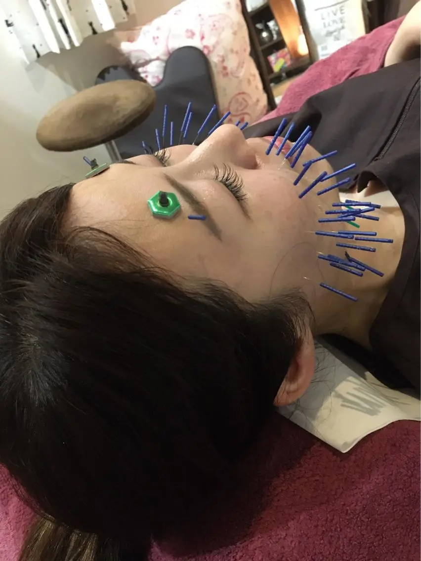 エステ リラク 美容鍼灸女性専用 りんご鍼灸治療院のその他イメージ