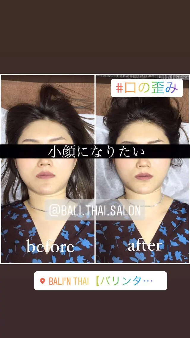 🌈歪み専門🌈 バリンタイ すぎうらのエステ・リラクイメージ