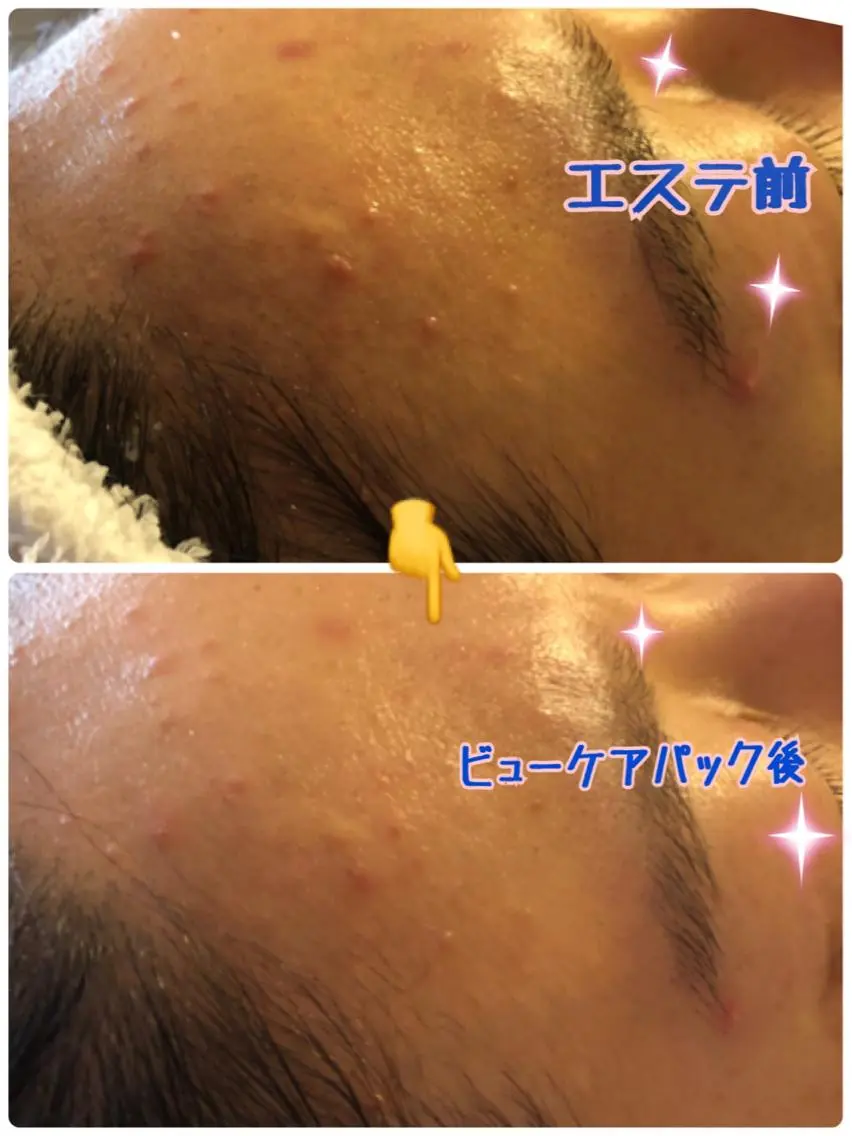 エステ 平岩 仁美のエステ・リラクイメージ