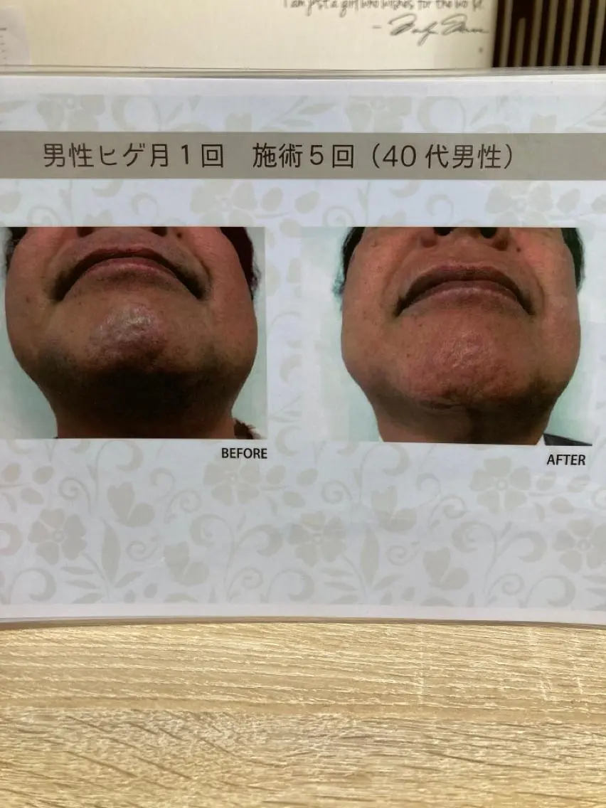 メンズ 矢野 つかさのマツエク・マツパデザイン