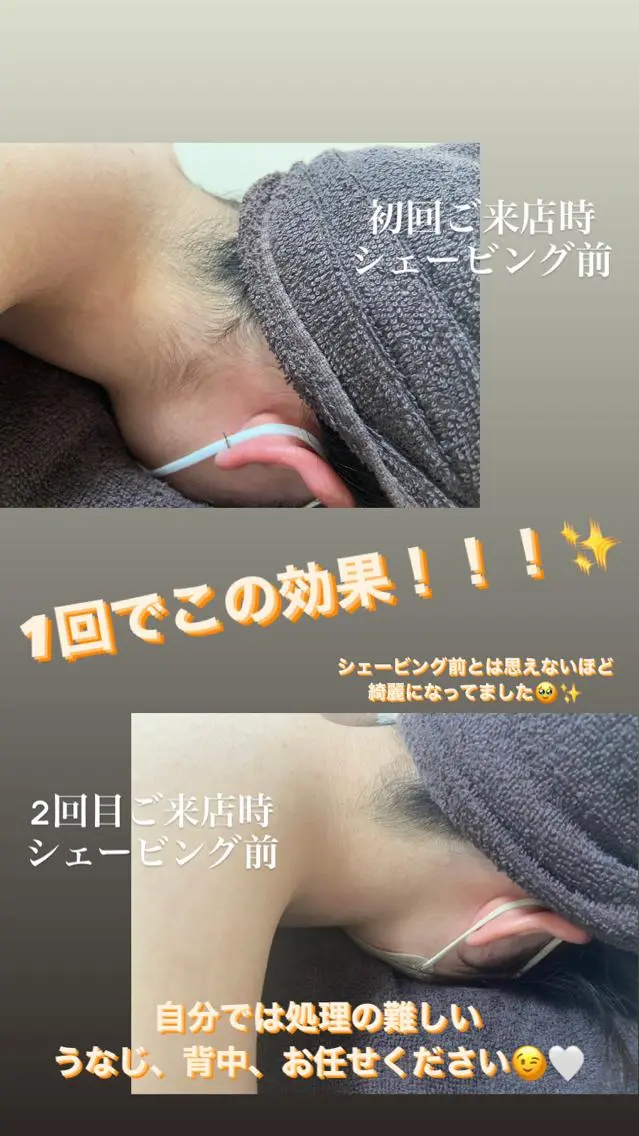 脱毛 Be Charm 山﨑のエステ・リラクイメージ