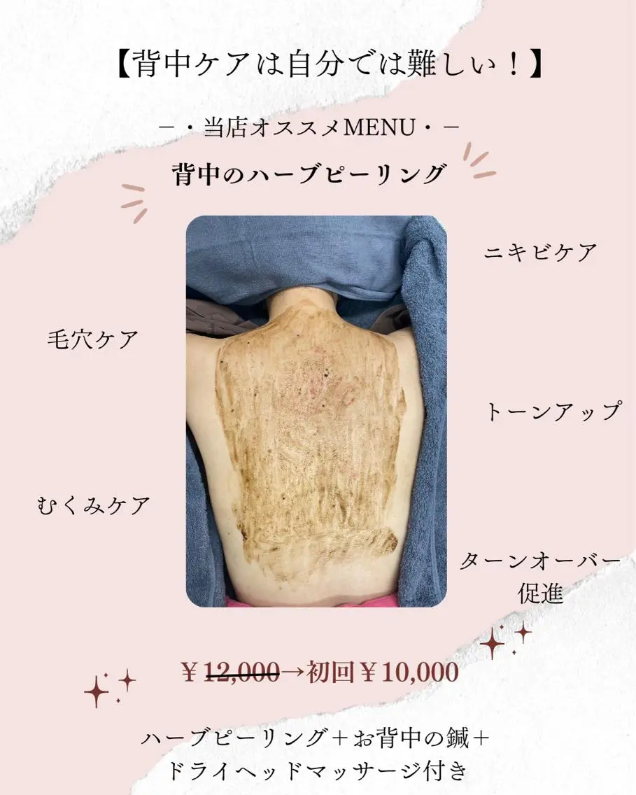 ニキビ特化美容鍼 ×ハーブピーリングのエステ・リラクイメージ