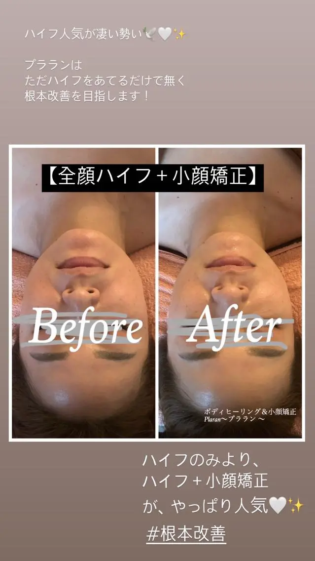 Plaran 〜プララン 〜のその他イメージ