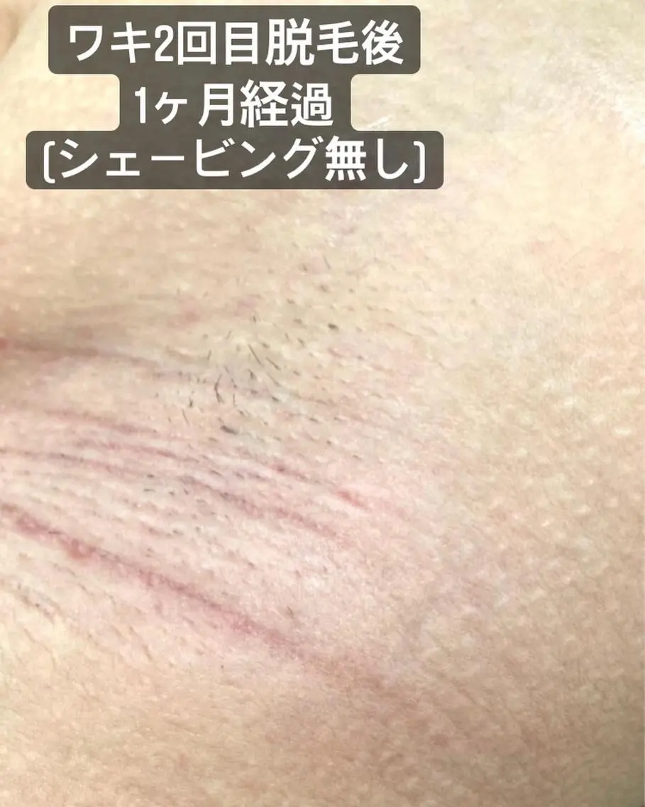 脱毛サロン Lilのエステ・リラクイメージ