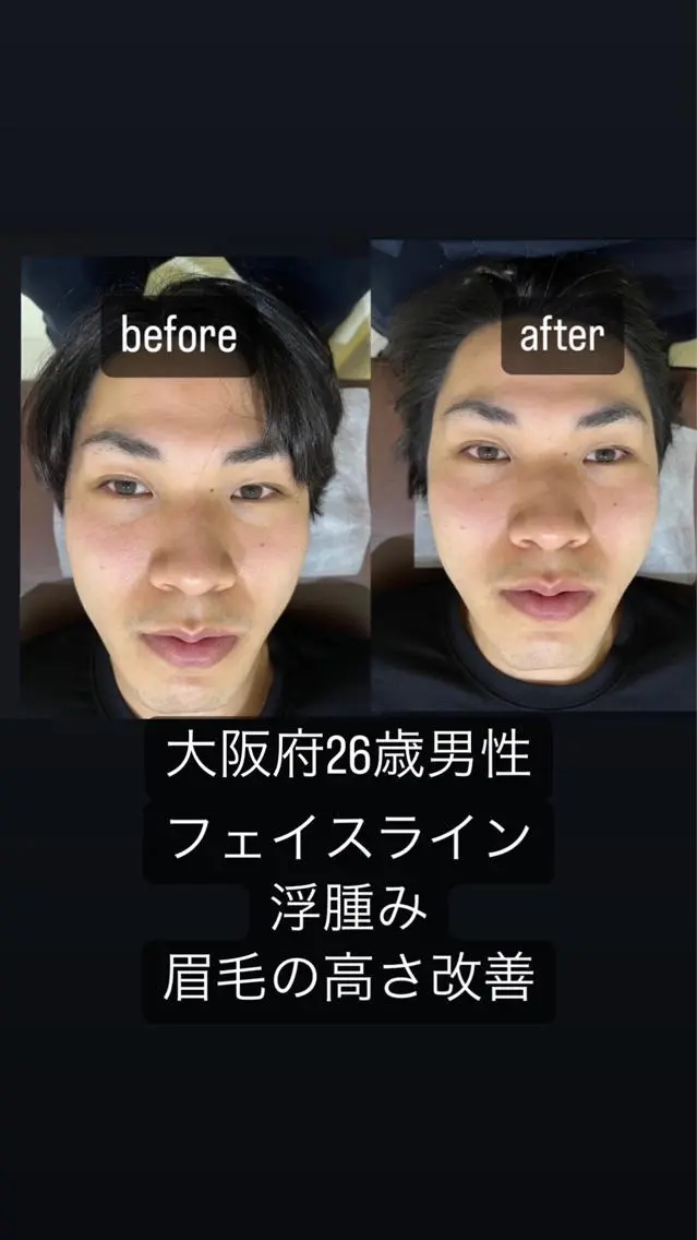 めばえ整骨院 城戸のエステ・リラクイメージ