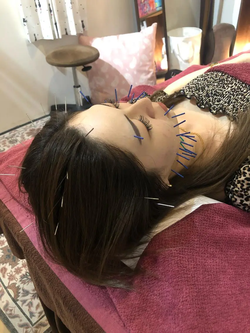 美容鍼灸女性専用 りんご鍼灸治療院のその他イメージ
