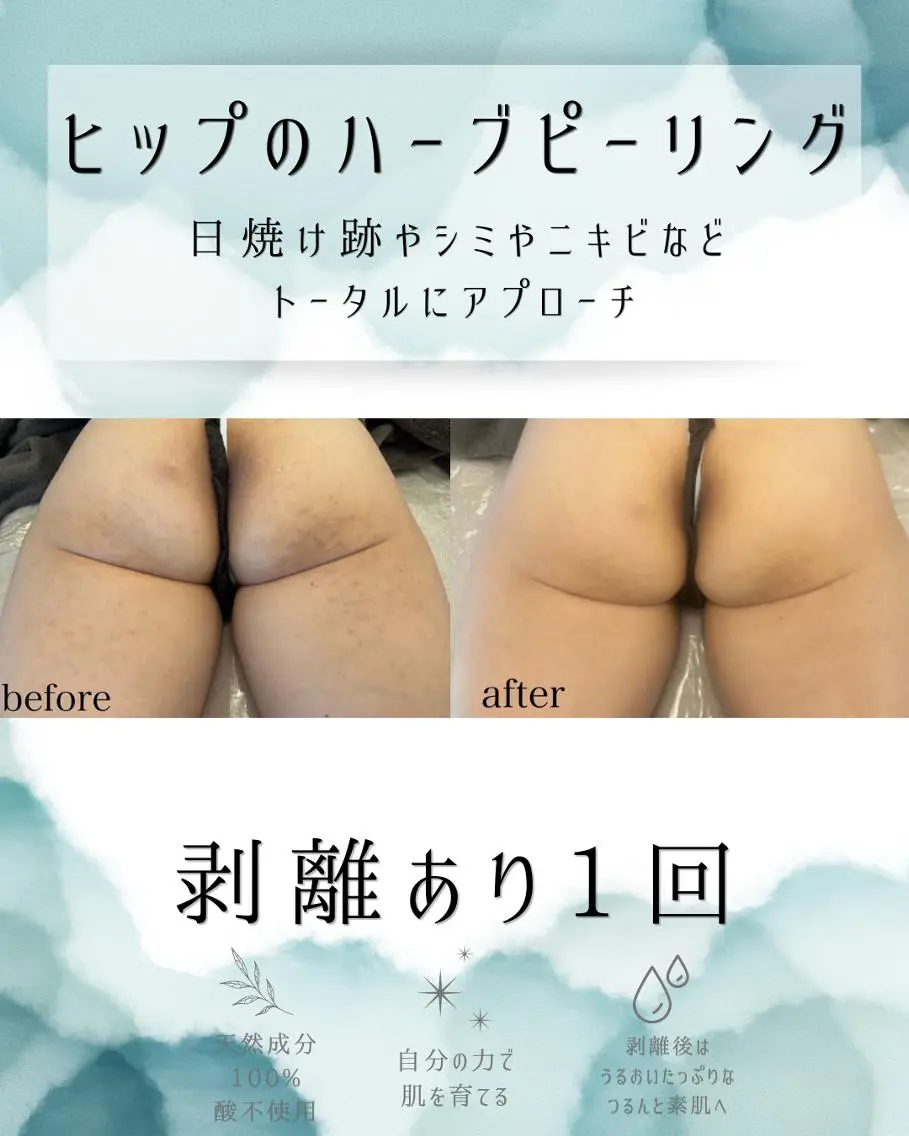 エステ リラク 医療提携 肌管理痩身エステ池袋のエステ・リラクイメージ