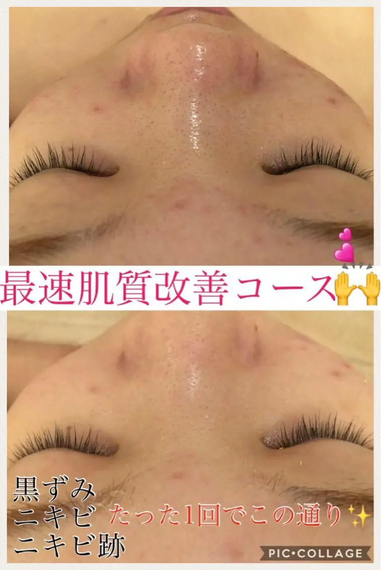 ショート カラー パーマ ヘアアレンジ メンズ キッズ ネイル マツエク・マツパ エステ リラク ニキビ・肌質改善専門 ♡人生が変わるサロンのエステ・リラクイメージ