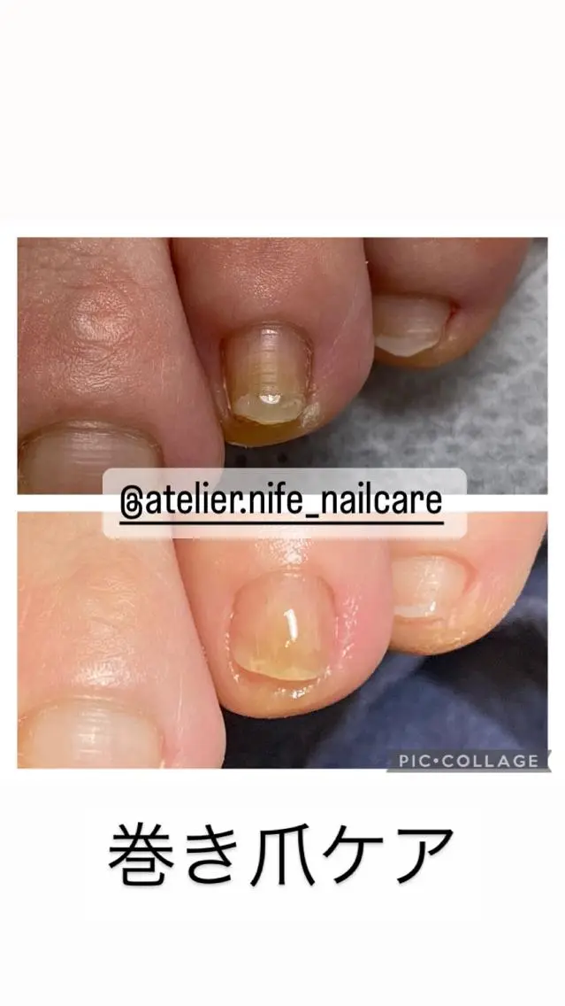 ネイル フットネイル atelier nife.のネイルデザイン
