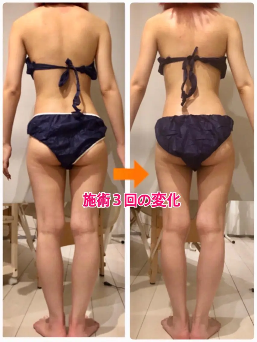 ロング カラー パーマ ヘアアレンジ メンズ キッズ ネイル マツエク・マツパ 痩身&ボディ 結果出し🌟丹野のエステ・リラクイメージ