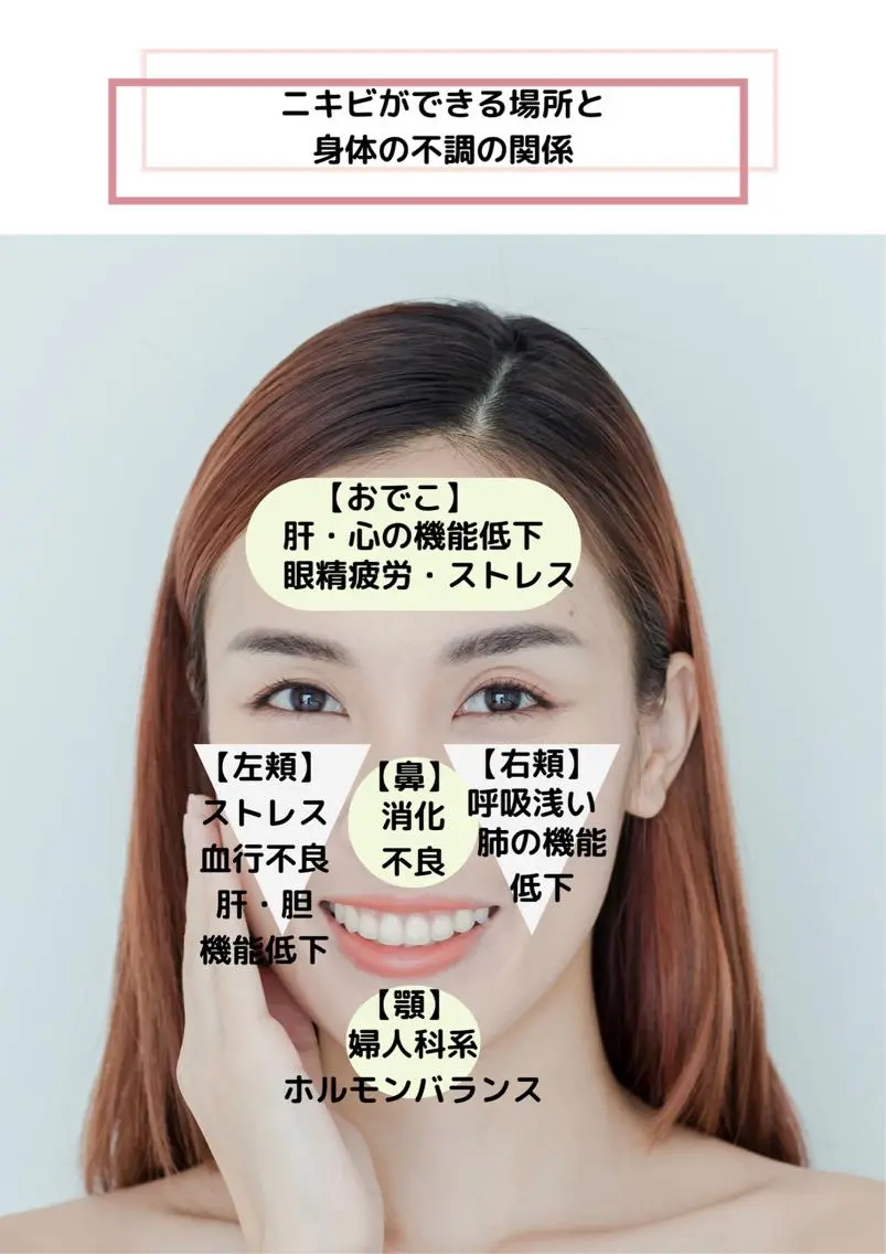 肌質改善美容鍼 ×ハーブピーリングのエステ・リラクイメージ