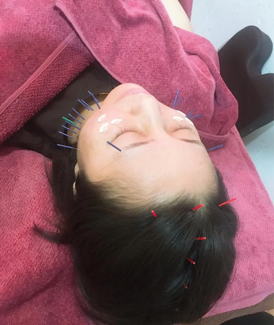 美容鍼灸女性専用 りんご鍼灸治療院のエステ・リラクイメージ