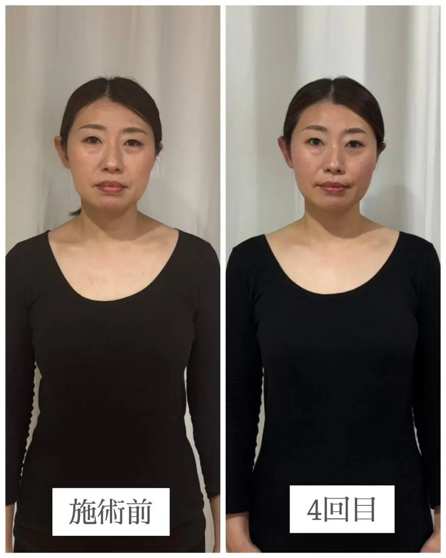 足から整える小顔矯正 全身美容矯正/中目黒のエステ・リラクイメージ