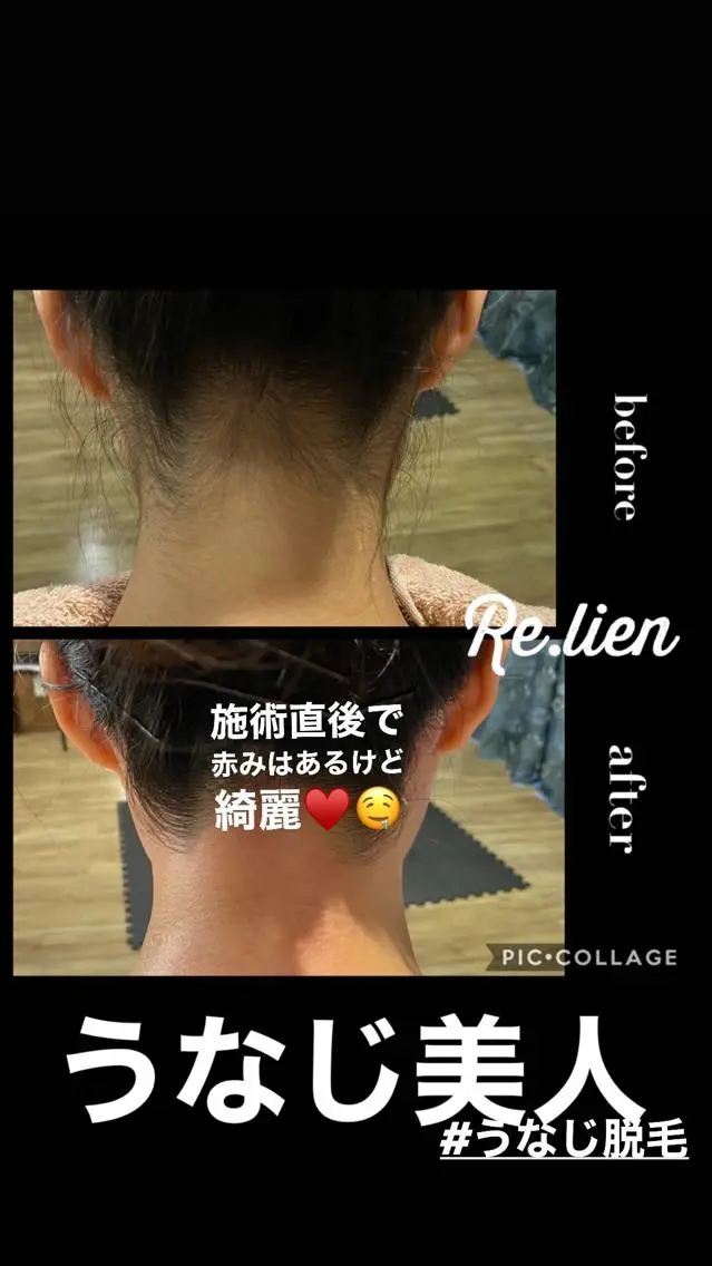 脱毛 Re.lien 白子菜美のエステ・リラクイメージ