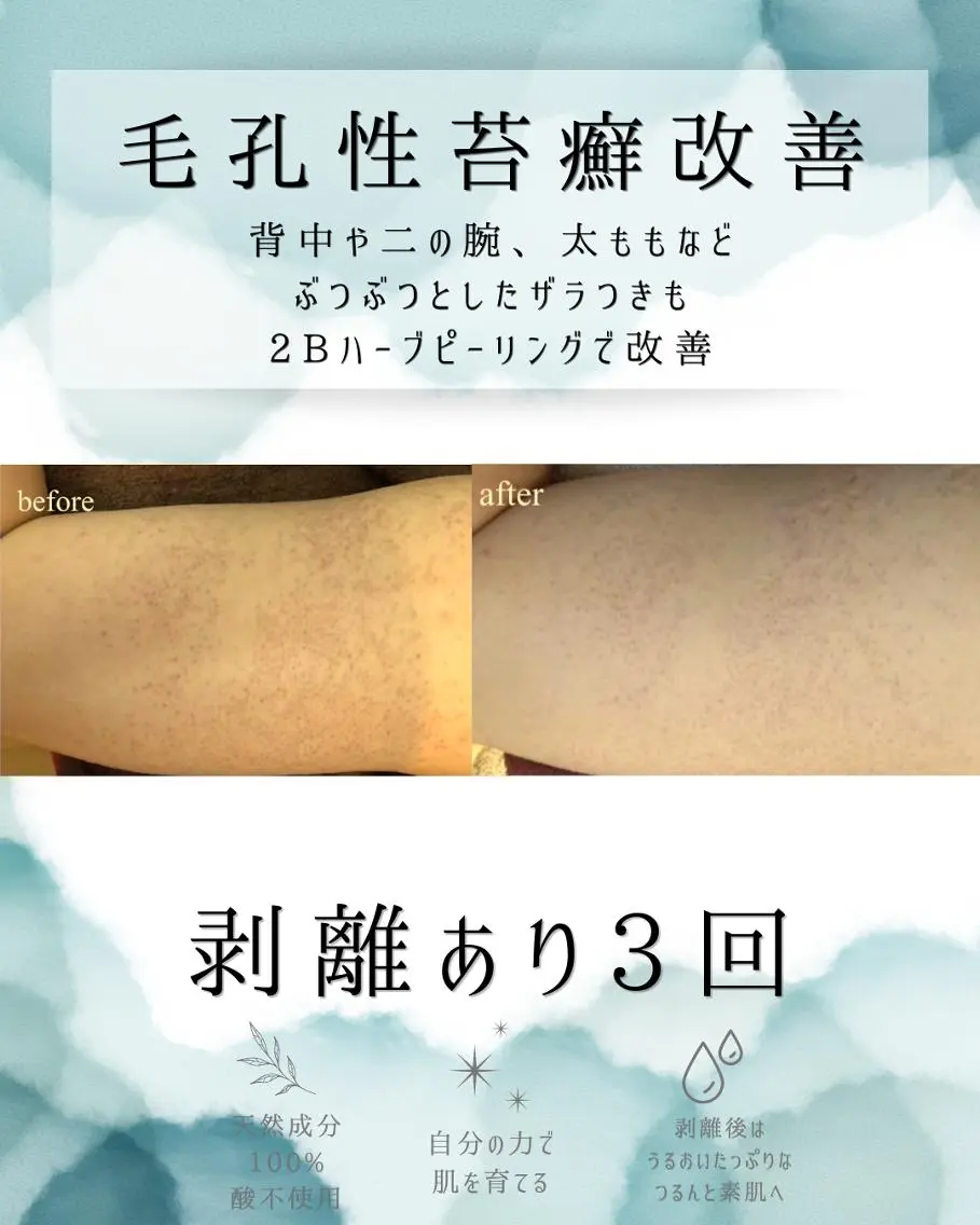 エステ リラク 医療提携 肌管理痩身エステ池袋のエステ・リラクイメージ