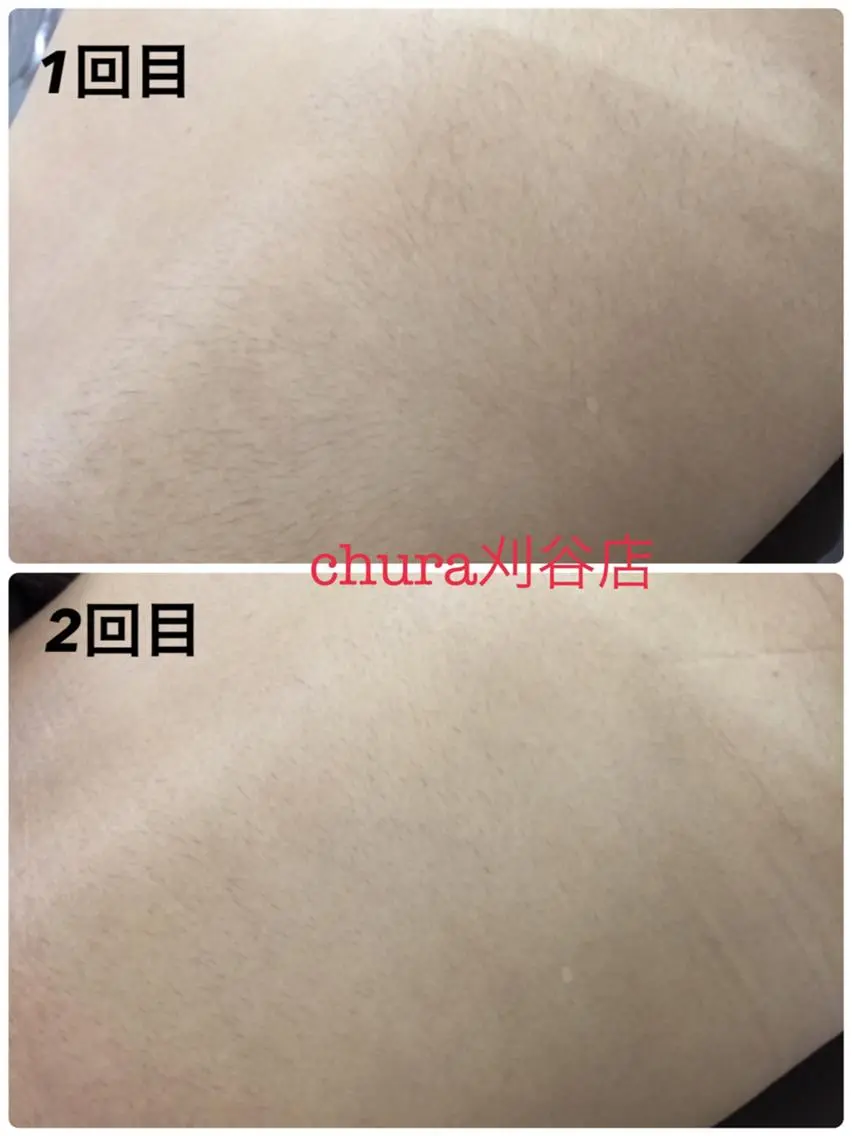 chura刈谷店☆ AESTHETICのエステ・リラクイメージ