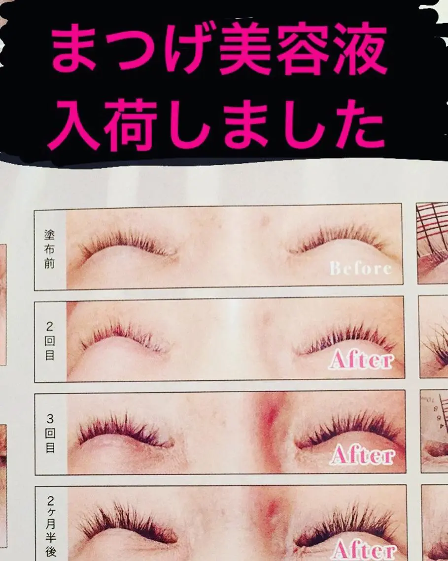 マツエク・マツパ 女性のお悩み美容 サロン　ヴィーナスのエステ・リラクイメージ