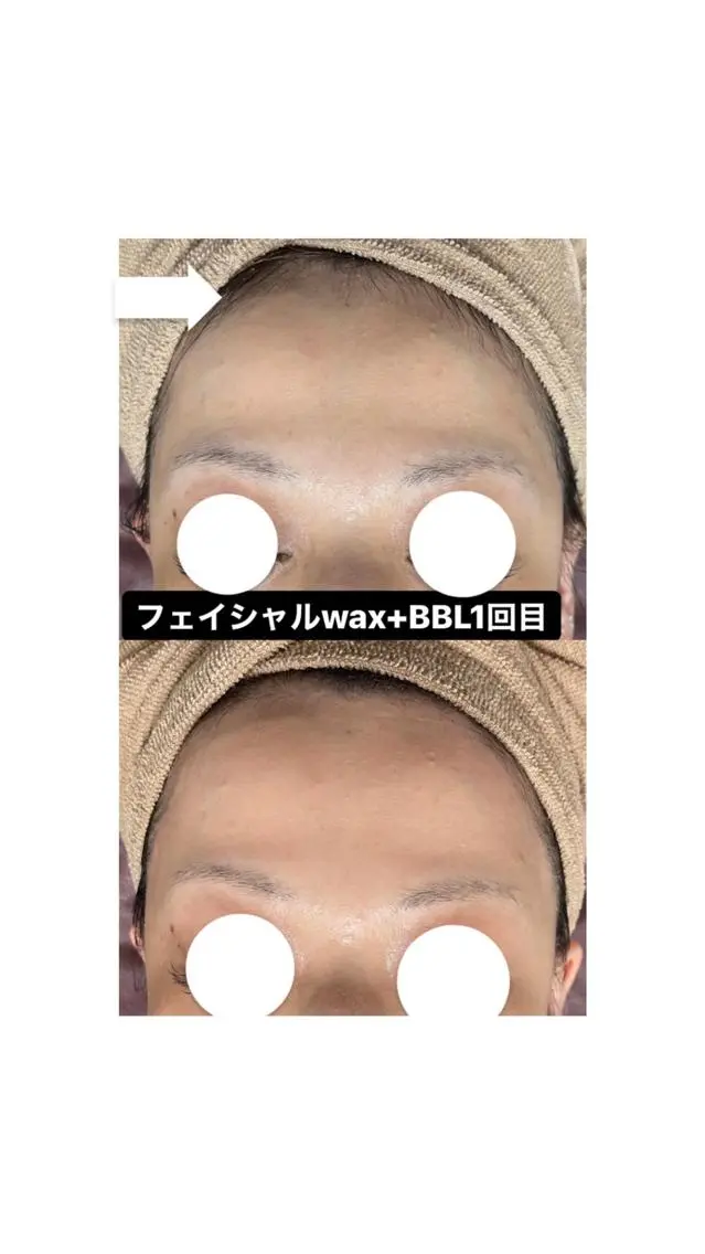Epina 千葉店 【エピナ】のエステ・リラクイメージ