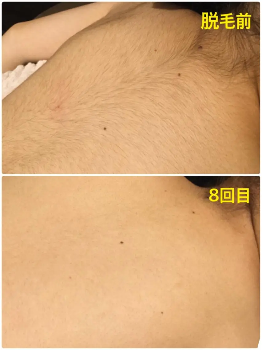 キッズ 脱毛 Dione 立川店のエステ・リラクイメージ