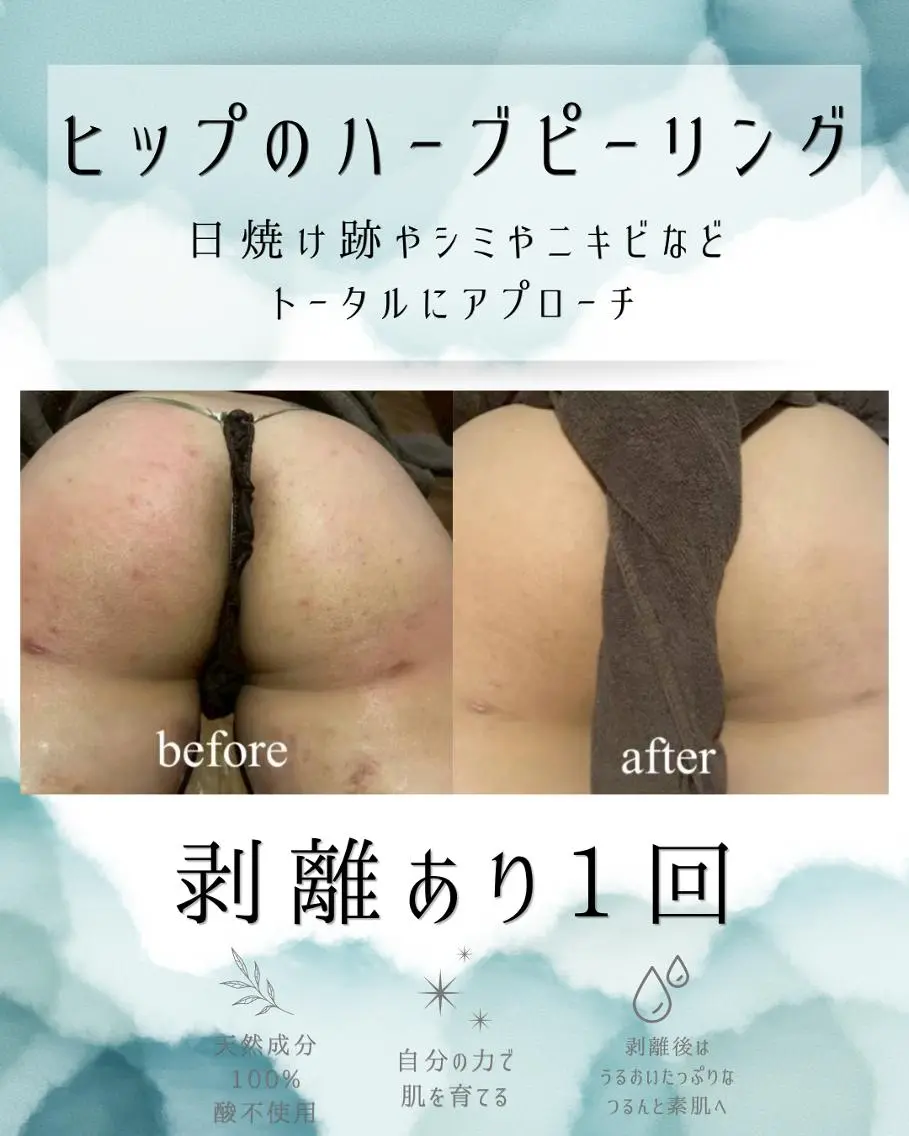 エステ リラク 医療提携 肌管理痩身エステ池袋のエステ・リラクイメージ
