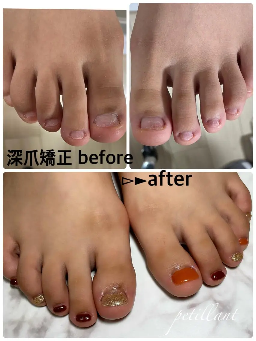 ネイル フットネイル ジェルネイル nail salon petillantのネイルデザイン