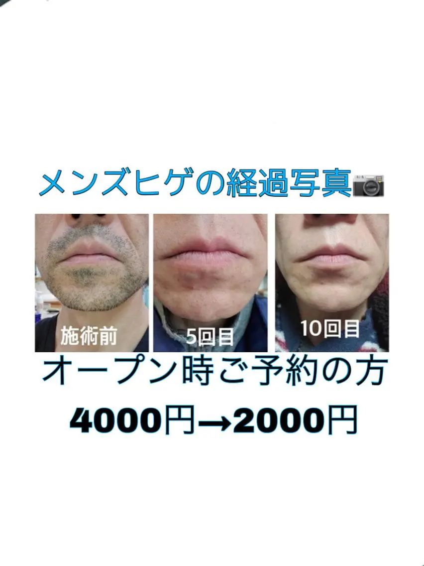 別府脱毛サロン Grandeのエステ・リラクイメージ
