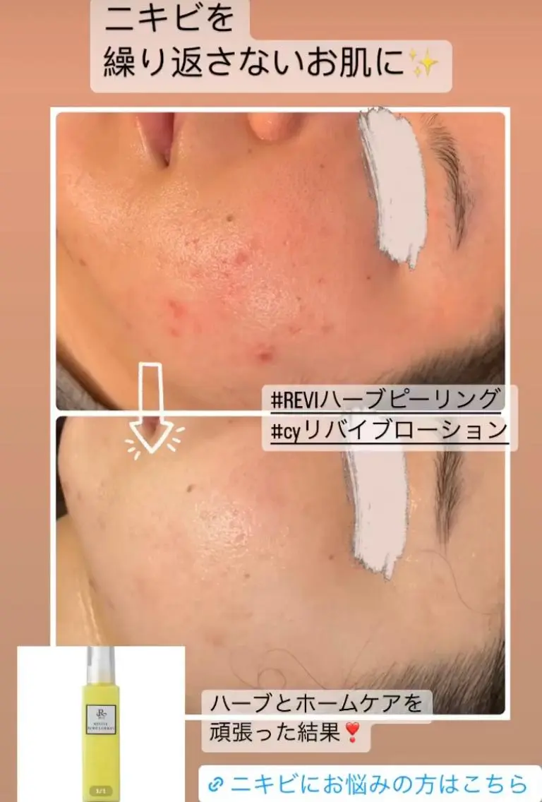 エステ kana ハーブピーリング🌿のエステ・リラクイメージ